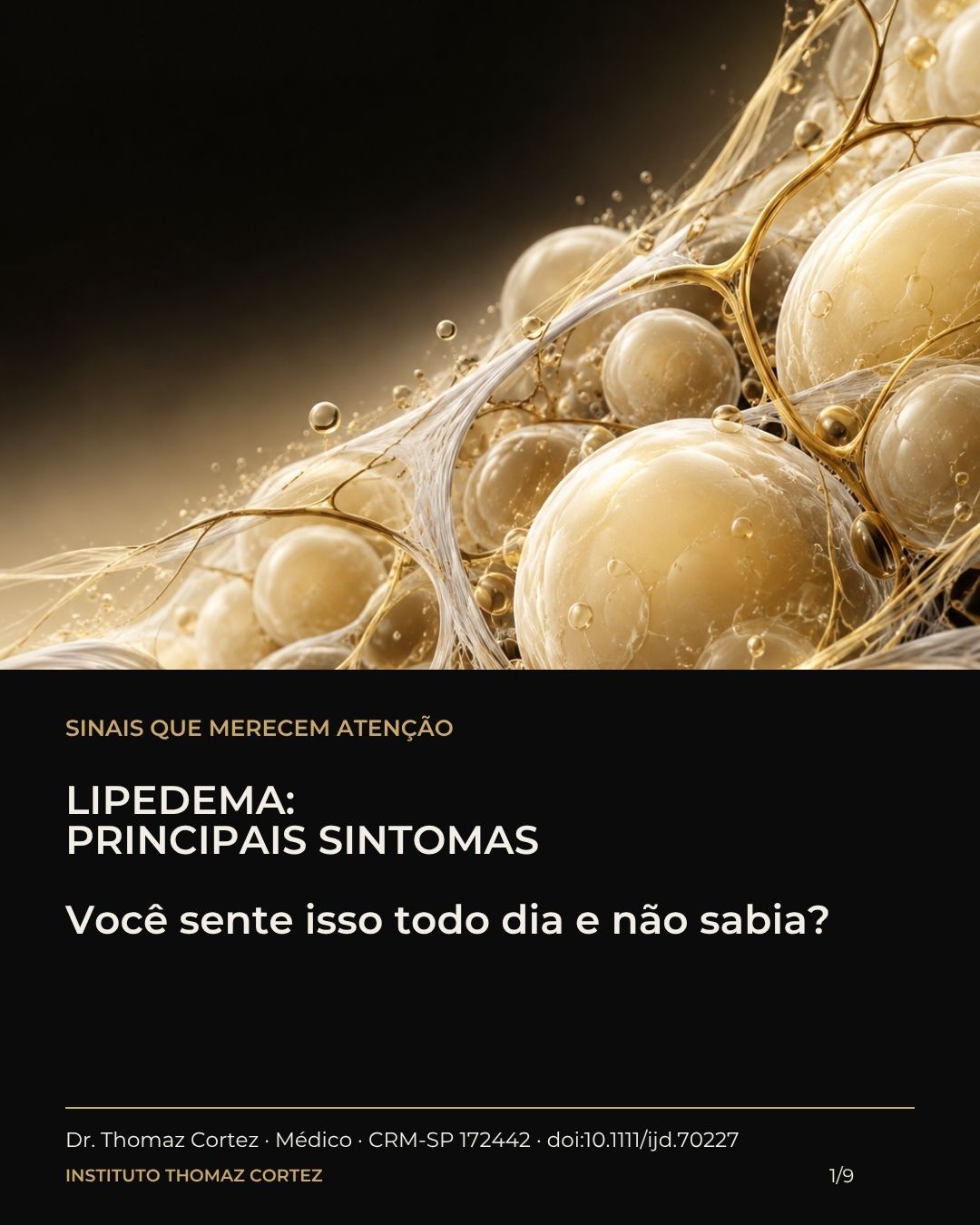 Arte original publicada sobre sinais de lipedema, com representação artística ilustrativa do tecido; não é micrografia nem imagem de paciente.
